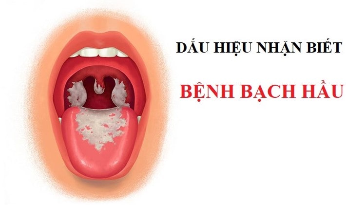 benh-bach-hau-min.jpg