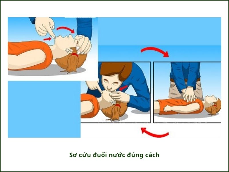 SƠ CỨU ĐUỐI NƯỚC ĐÚNG CÁCH